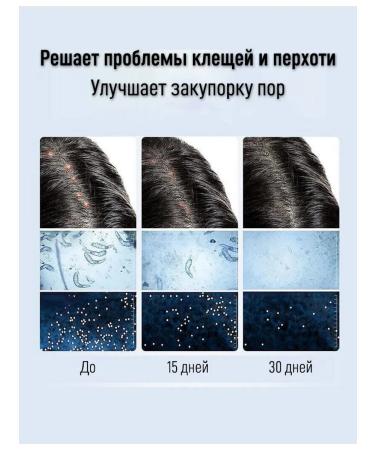 Hunmui Anti-dandruff shampoo with selenium disulfide against seborrhea and itching 250 ml - Buy Online on GoSupps.com