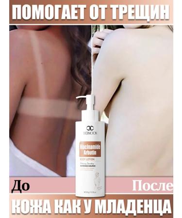 LYDIMOON Moisturizing body cream helps from cracks 300g