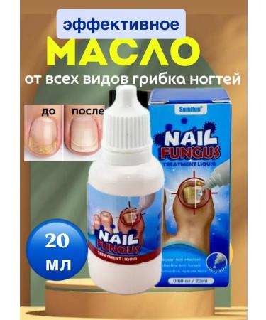 Remedy for toenail fungus