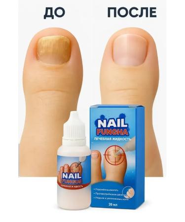 Remedy for toenail fungus - Buy Online on GoSupps.com