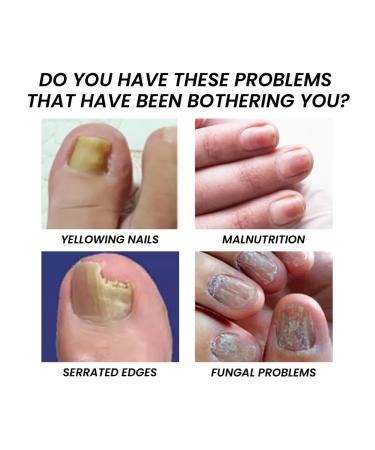 West & Month oil to strengthen the cuticle of nails - Buy Online on GoSupps.com