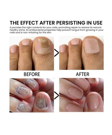 West & Month oil to strengthen the cuticle of nails - Buy Online on GoSupps.com