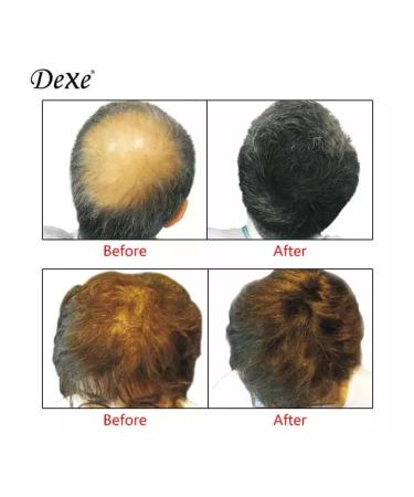Dexe Hair thickener Hair Building Fibers - Buy Online on GoSupps.com