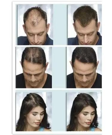 Dexe Hair thickener Hair Building Fibers - Buy Online on GoSupps.com