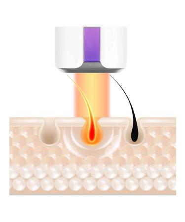 Yamaguchi IPL Hair Removal laser photoeplator - Buy Online on GoSupps.com