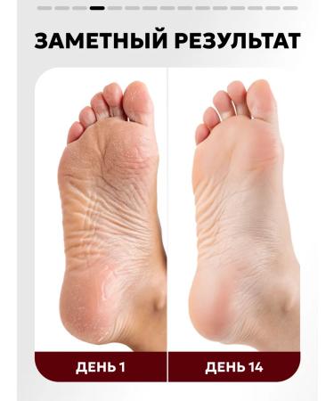 Semily Set cream cream is nutritious from cracks for dry skin 3 pcs - Buy Online on GoSupps.com