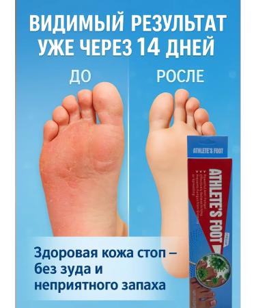 KEVO Skin cream near the fingers of the foot - Buy Online on GoSupps.com