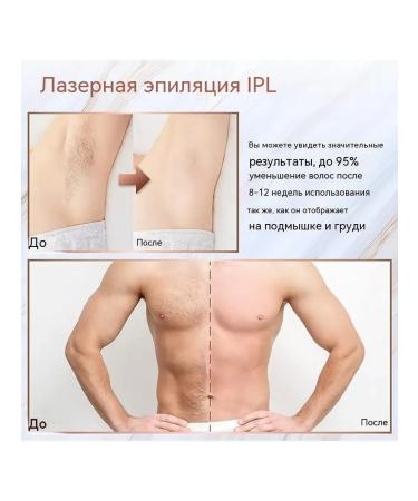 Laser photoeplator is professional - Buy Online on GoSupps.com