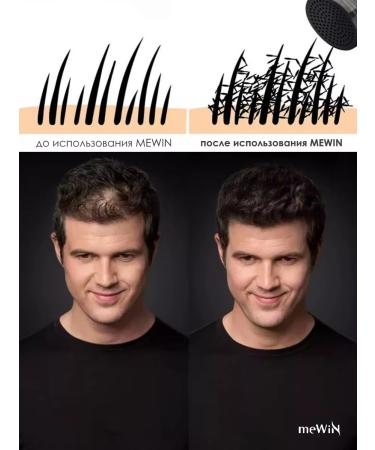 Mewin Thickener for hair black 25 grams - Buy Online on GoSupps.com