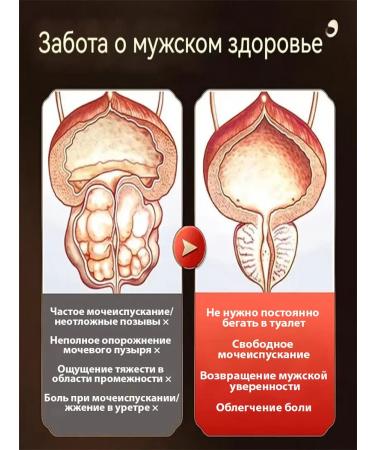 prostatitis treatment for men Chinese - Buy Online on GoSupps.com