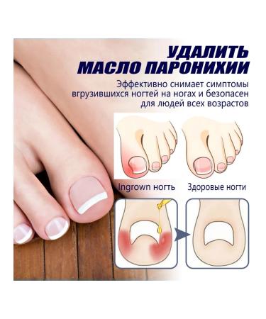 Lacques for an ingrown nail from the fungus for treatment 4 pcs - Buy Online on GoSupps.com