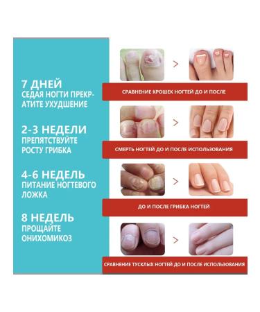 South Moon Night -footing plasters for nails 16 pcs - Buy Online on GoSupps.com