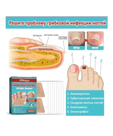 South Moon Night -footing plasters for nails 16 pcs - Buy Online on GoSupps.com