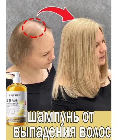 Ginger shampoo against hair loss and hair growth