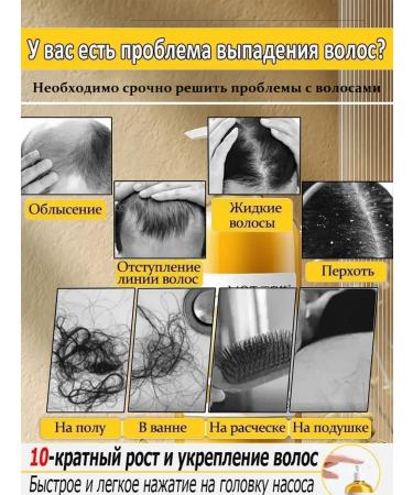 Ginger shampoo against hair loss and hair growth - Buy Online on GoSupps.com