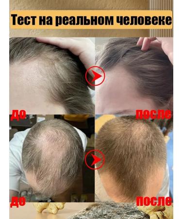 Ginger shampoo against hair loss and hair growth - Buy Online on GoSupps.com