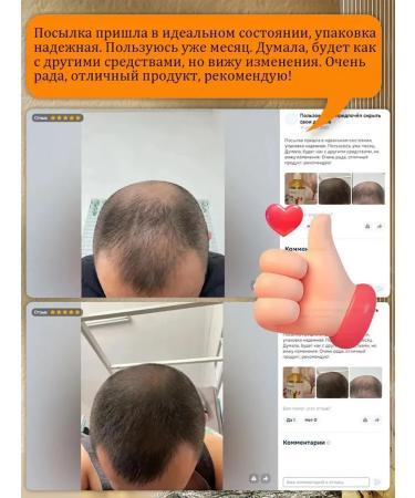 Ginger shampoo against hair loss and hair growth - Buy Online on GoSupps.com