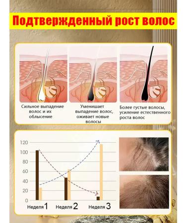 Ginger shampoo against hair loss and hair growth - Buy Online on GoSupps.com