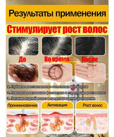 Ginger shampoo against hair loss and hair growth - Buy Online on GoSupps.com