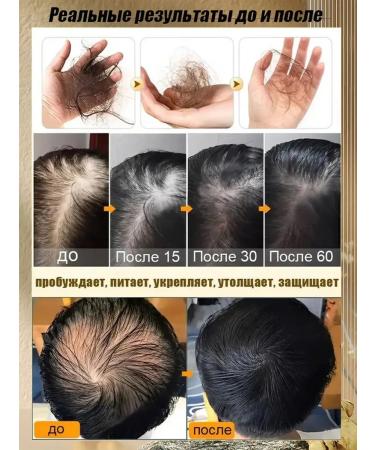 Ginger shampoo against hair loss and hair growth - Buy Online on GoSupps.com