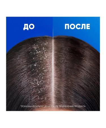 Head&Shoulders Shampoo against hair loss from dandruff 400 ml - Buy Online on GoSupps.com