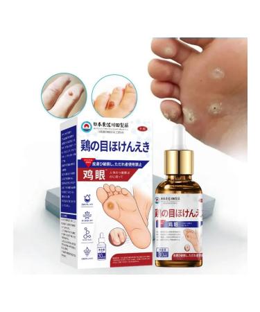 DRSKINVITA Getting rid of corns and calluses - Buy Online on GoSupps.com