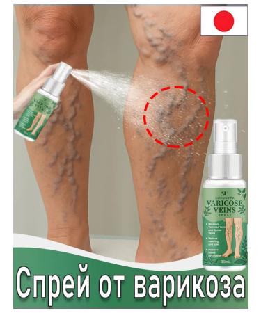 The spray from varicose veins effectively treats edema 30 ml