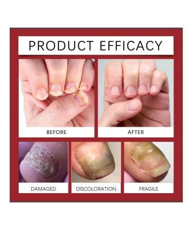 Ximonth soft moisturizing patching nails - Buy Online on GoSupps.com