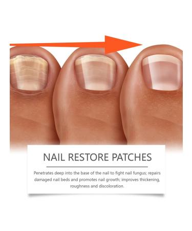 Ximonth soft moisturizing patching nails - Buy Online on GoSupps.com