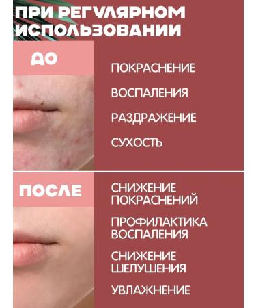 makeup remover Sensibio Gel a cleansing gel that moisturizes and soothes fights acne and redness 200 ml - Buy Online on GoSupps.com