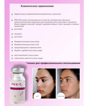 Professional Piling PRXT33 (PRHT33) - Buy Online on GoSupps.com