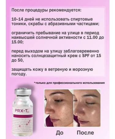 Professional Piling PRXT33 (PRHT33) - Buy Online on GoSupps.com