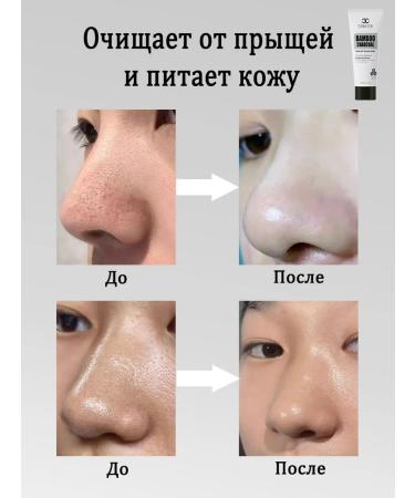 LYDIMOON Mask for removing black dots 60 g - Buy Online on GoSupps.com