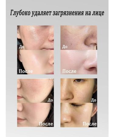 LYDIMOON Mask for removing black dots 60 g - Buy Online on GoSupps.com