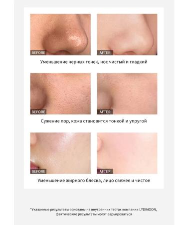 LYDIMOON Mask for removing black dots 60 g 5 pcs - Buy Online on GoSupps.com