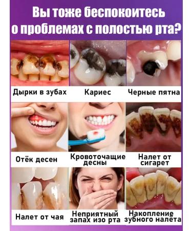 LYDIMOON Toothpaste whitening from plaque and stone set 2 pcs - Buy Online on GoSupps.com