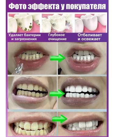 LYDIMOON Toothpaste whitening from plaque and stone set 2 pcs - Buy Online on GoSupps.com