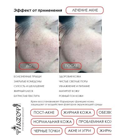 ASFARY LABEL LAB Cream for problem skin with SPF30 daily 50 ml - Buy Online on GoSupps.com