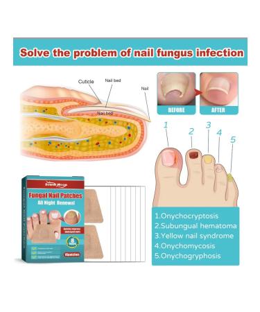 South Moon Moisturizing Care for shine stickers for but ... - Buy Online on GoSupps.com