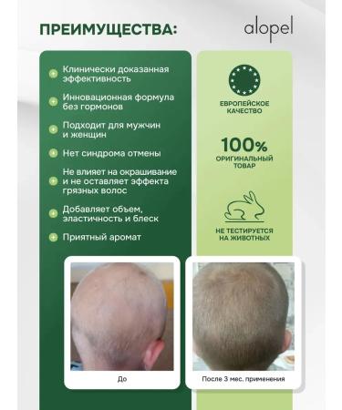 CATALYSIS Alopel (alopel) foam against hair loss 2 pcs - Buy Online on GoSupps.com