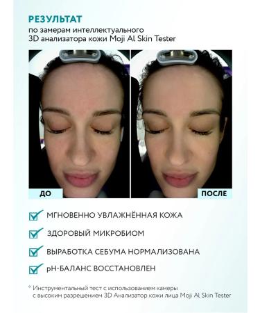 ARAVIA Laboratories Balancing face toner Galactomyces Theraphas 200 ml - Buy Online on GoSupps.com