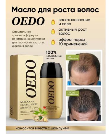 OEDO Hair growth oil 2 pcs. - Buy Online on GoSupps.com
