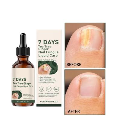 3 B massagers for cuticle and nails with ginger Moisturization - Buy Online on GoSupps.com