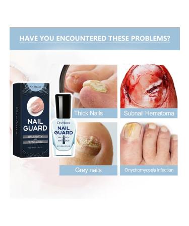 Serum for strengthening nails 15ml - Buy Online on GoSupps.com