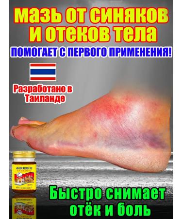 Ointment from bruises and edema of the body 120ml
