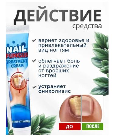 Antibacterial nail cream 20 ml - Buy Online on GoSupps.com