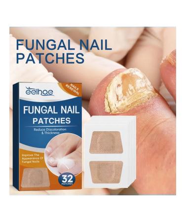 Eelhoe fungus of a gray nail thickening restoration manual ... - Buy Online on GoSupps.com