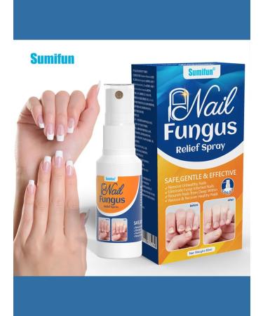 Nail Fungus spray from nail fungus on the legs of onychomycosis 30 ml - Buy Online on GoSupps.com
