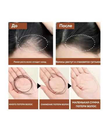 eelhoe Against hair loss power air conditioning repair is damaged - Buy Online on GoSupps.com