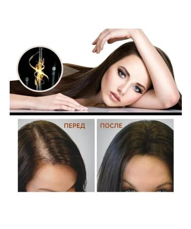 eelhoe Against hair loss power air conditioning repair is damaged - Buy Online on GoSupps.com
